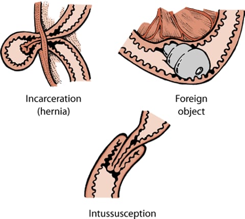 Illustration of three types of bowel obstructions in dogs.